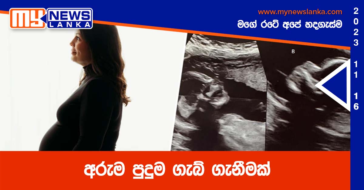 අරුම පුදුම ගැබ් ගැනීමක්