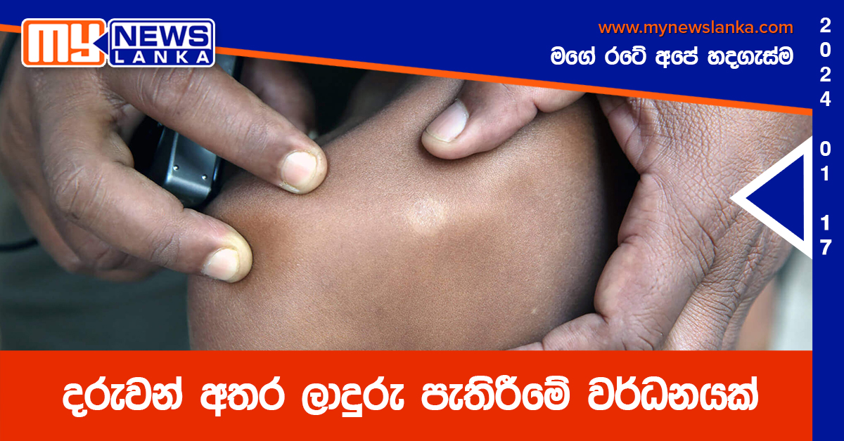 දරුවන් අතර ලාදුරු පැතිරීමේ වර්ධනයක් දරුවන් අතර ලාදුරු පැතිරීමේ වර්ධනයක්