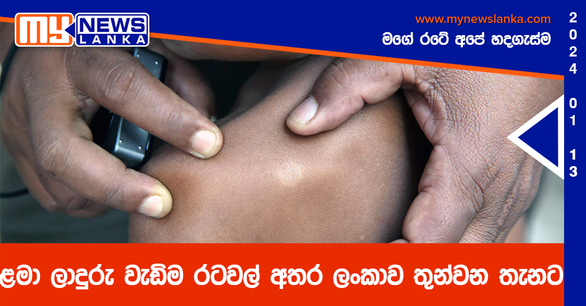 ළමා ලාදුරු වැඩිම රටවල් අතර ලංකාව තුන්වන තැනට