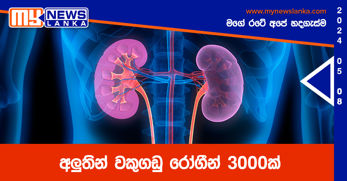 අලුතින් වකුගඩු රෝගීන් 3000ක් අලුතින් වකුගඩු රෝගීන් 3000ක්