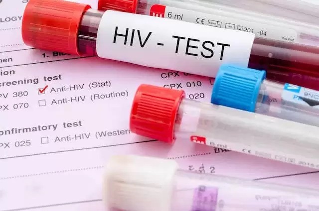 හම්බන්තොට දිස්ත්රික්කයේ HIV ආසාදිතයින් සීඝ්ර යෙන් ඉහළට හම්බන්තොට දිස්ත්රික්කයේ HIV ආසාදිතයින් සීඝ්ර යෙන් ඉහළට