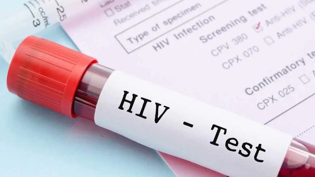 නව යෞවනයන් අතර HIV අවදානම ඉහළට